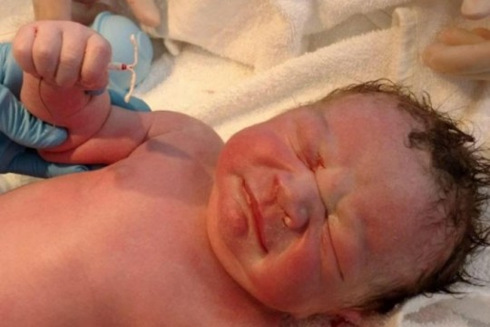 Uimitor! Un bebeluș s-a născut cu steriletul mamei în mână