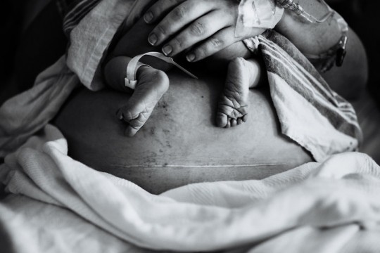 Fotografiile impresionante care au învins la Concursul despre naștere și maternitate
