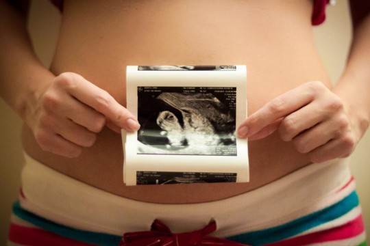 La 13 săptămâni de sarcină burtica devine mai vizibilă