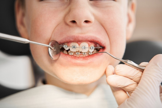 Legătura dintre alinierea dentară și postura corpului la copii