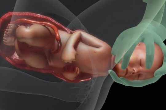 Medic obstetrician-ginecolog despre rolul bacteriilor vaginale în imunizarea nou-născuților