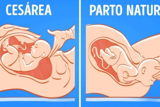 Medic obstetrician-ginecolog despre operația cezariană: Presupune o serie de riscuri atât pentru mamă, cât și pentru făt